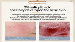 Lansiyi 2% Salicylic Acid Acne Treatment Serum - 15ml