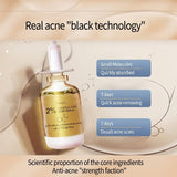 Lansiyi 2% Salicylic Acid Acne Treatment Serum - 15ml