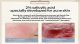 Lansiyi 2% Salicylic Acid Acne Treatment Serum - 15ml